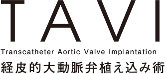 TAVI - Transcatheter Aortic Valve Implantation