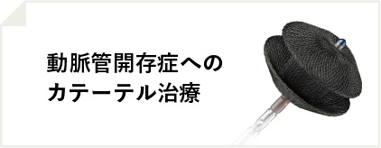 動脈管開存症へのカテーテル治療