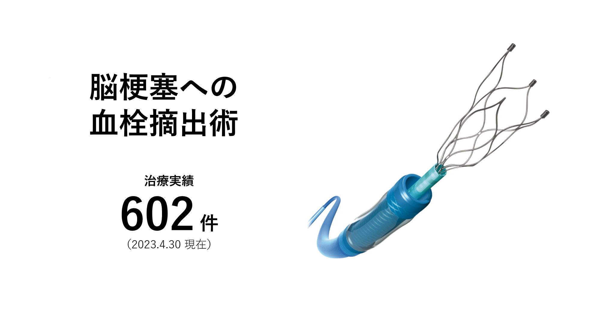 脳梗塞への血栓摘出術