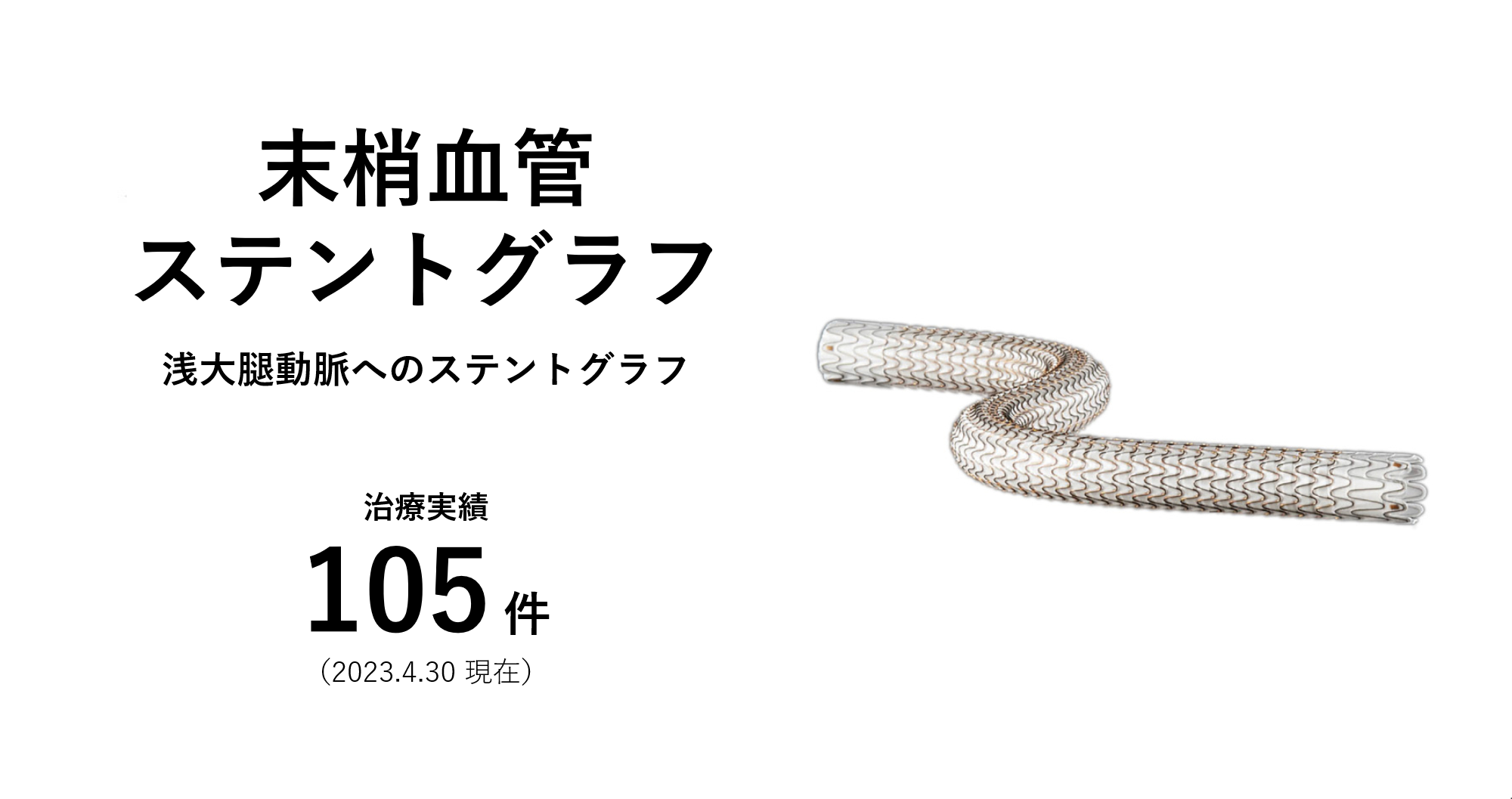 末梢血管ステントグラフ