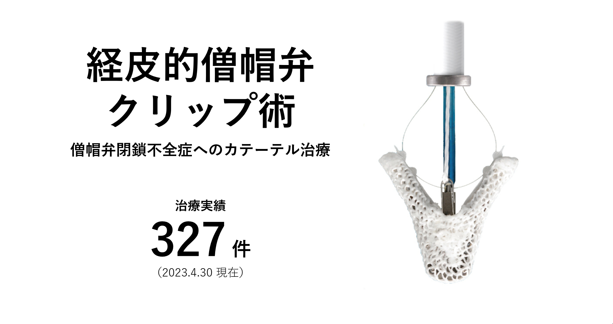 経皮的僧帽弁クリップ