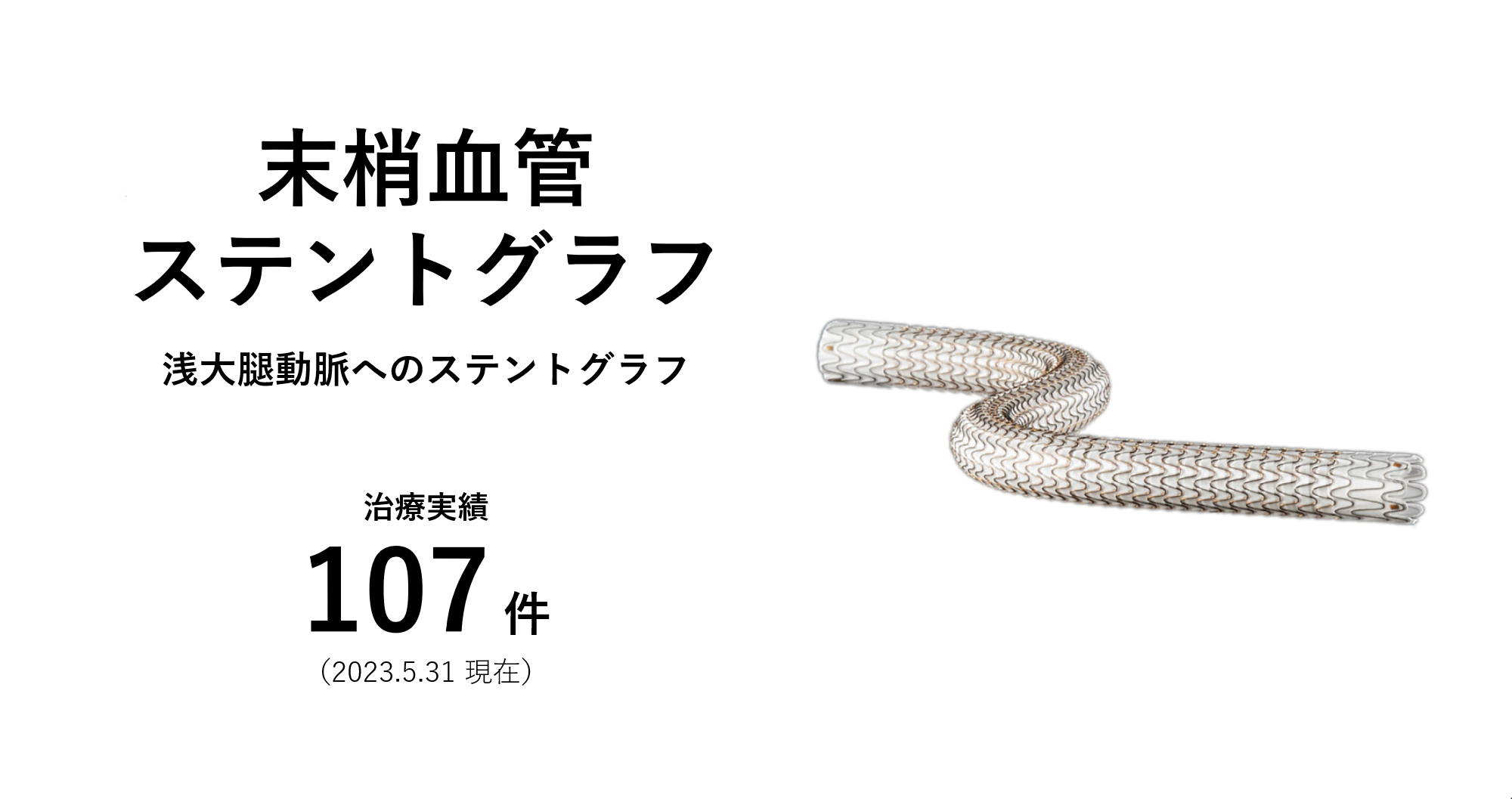 末梢血管ステントグラフ