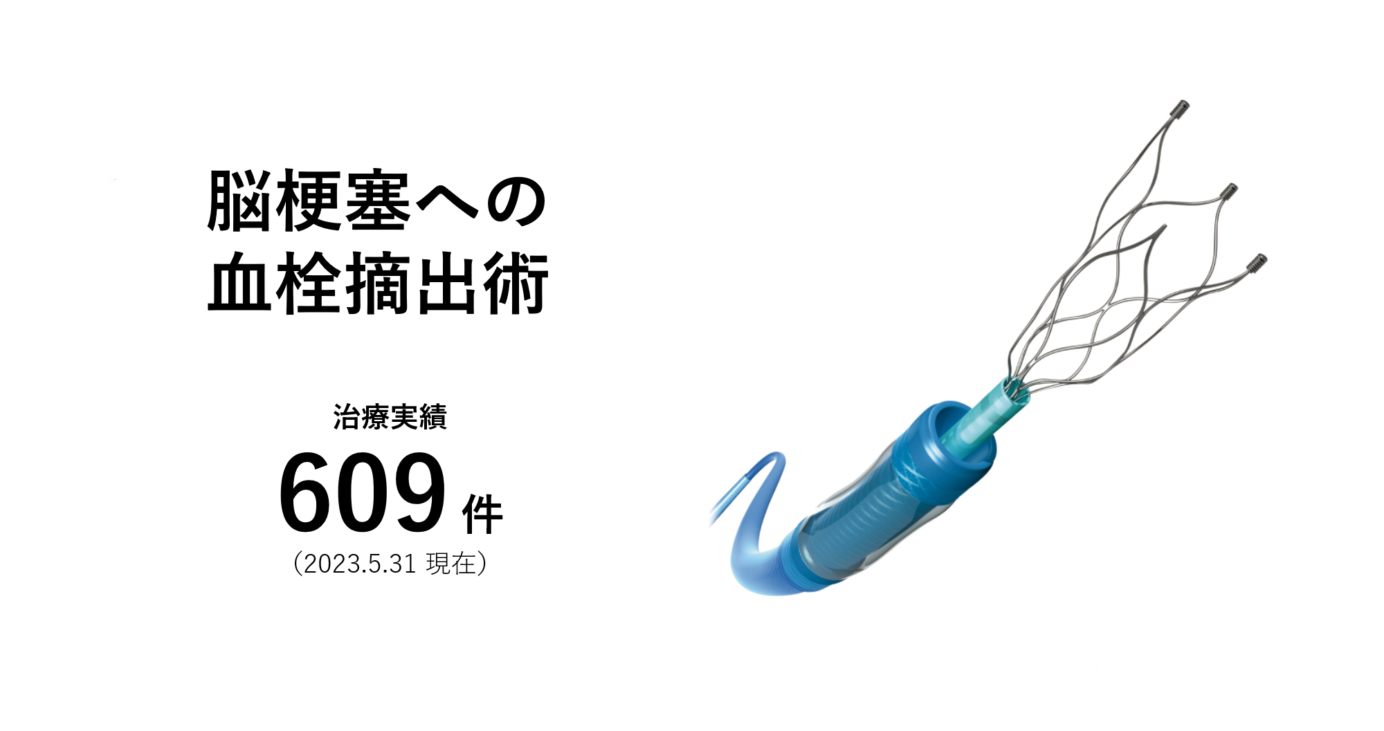 脳梗塞への血栓摘出術