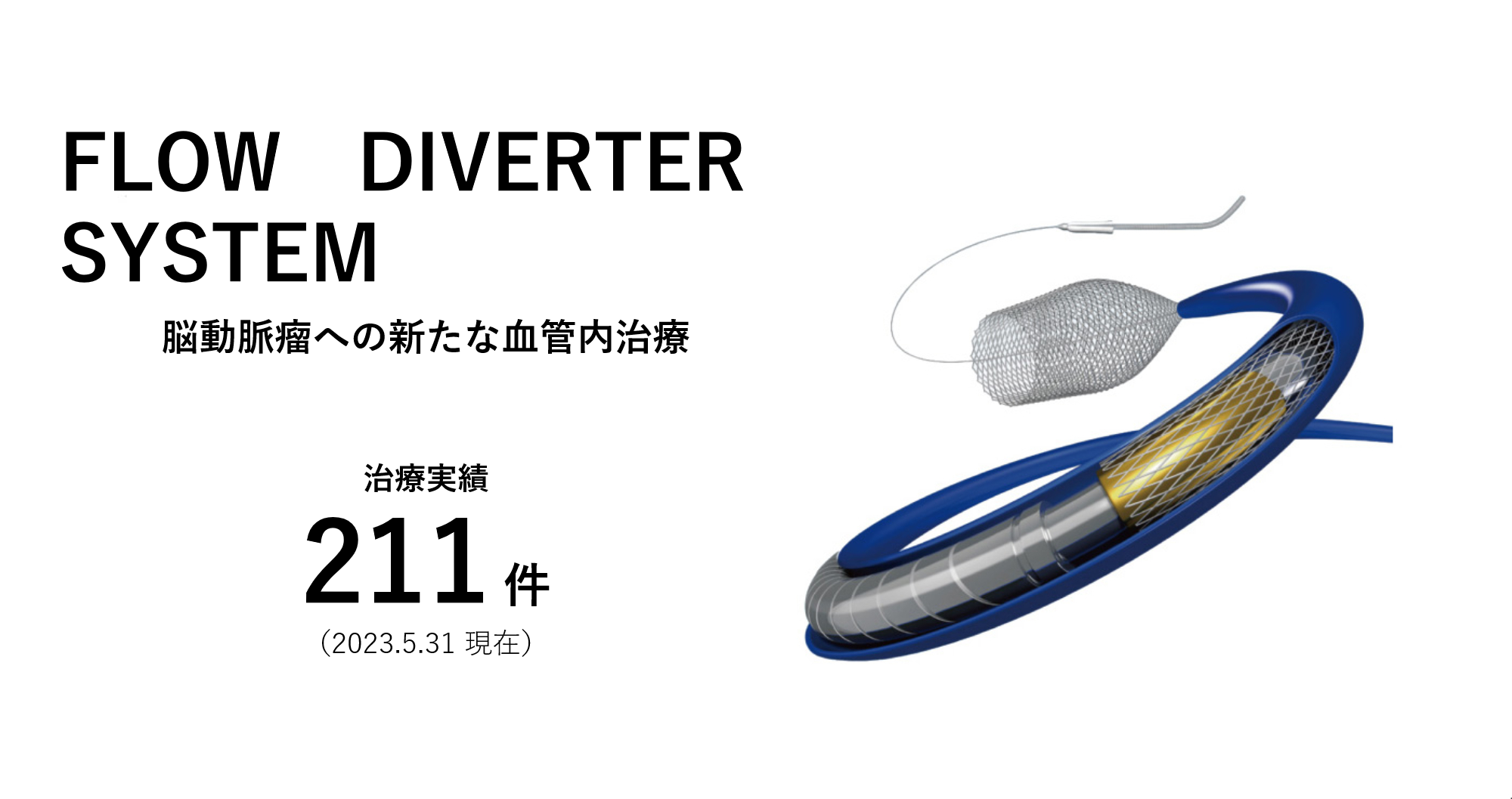 FROW DIVERIER SYSTEM