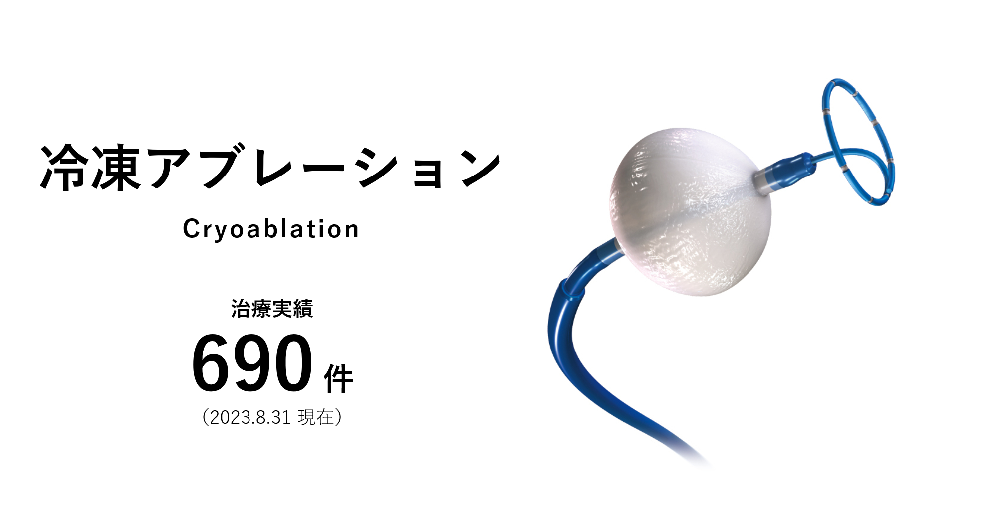 冷凍アブレーション