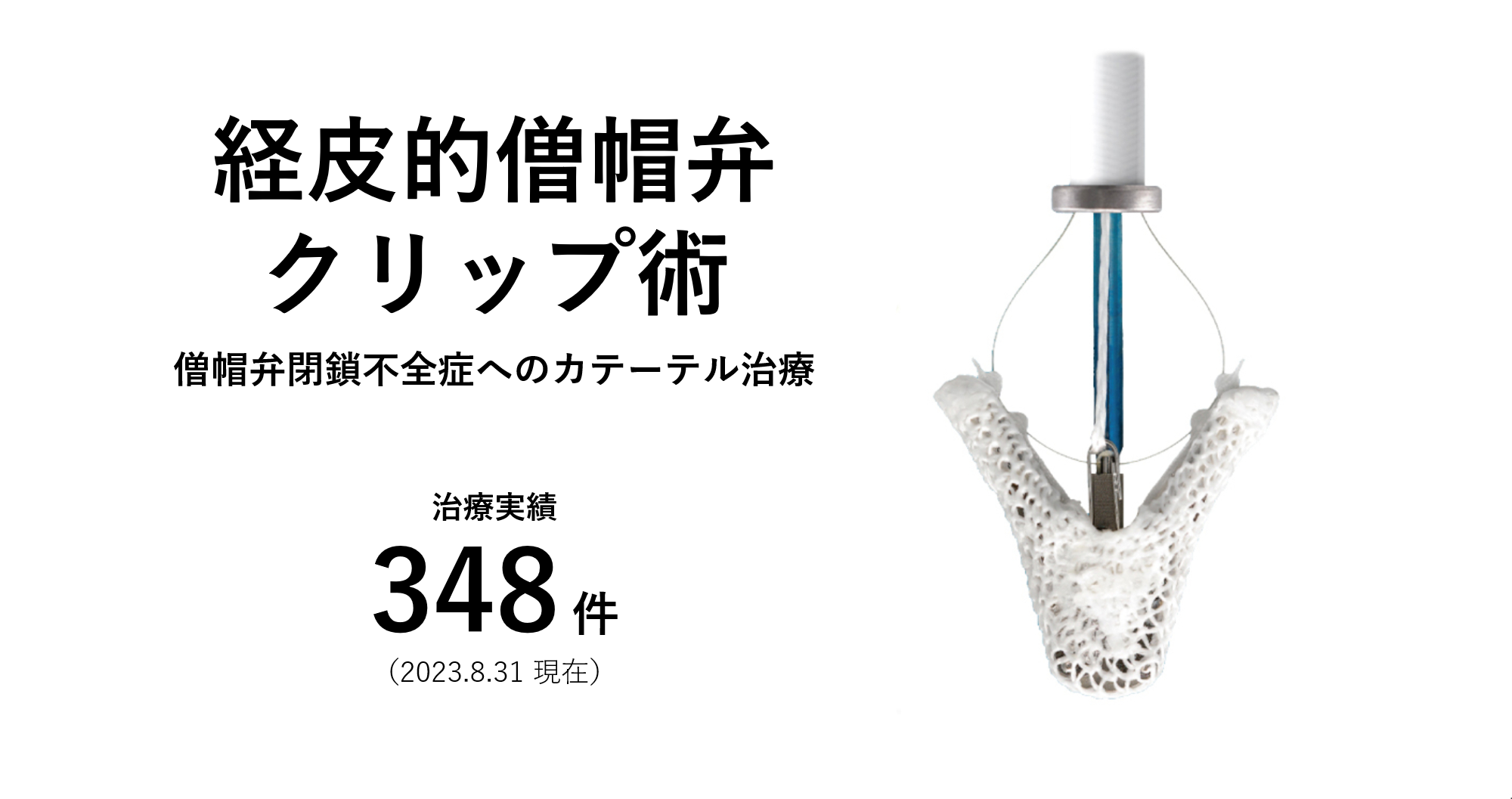 経皮的僧帽弁クリップ