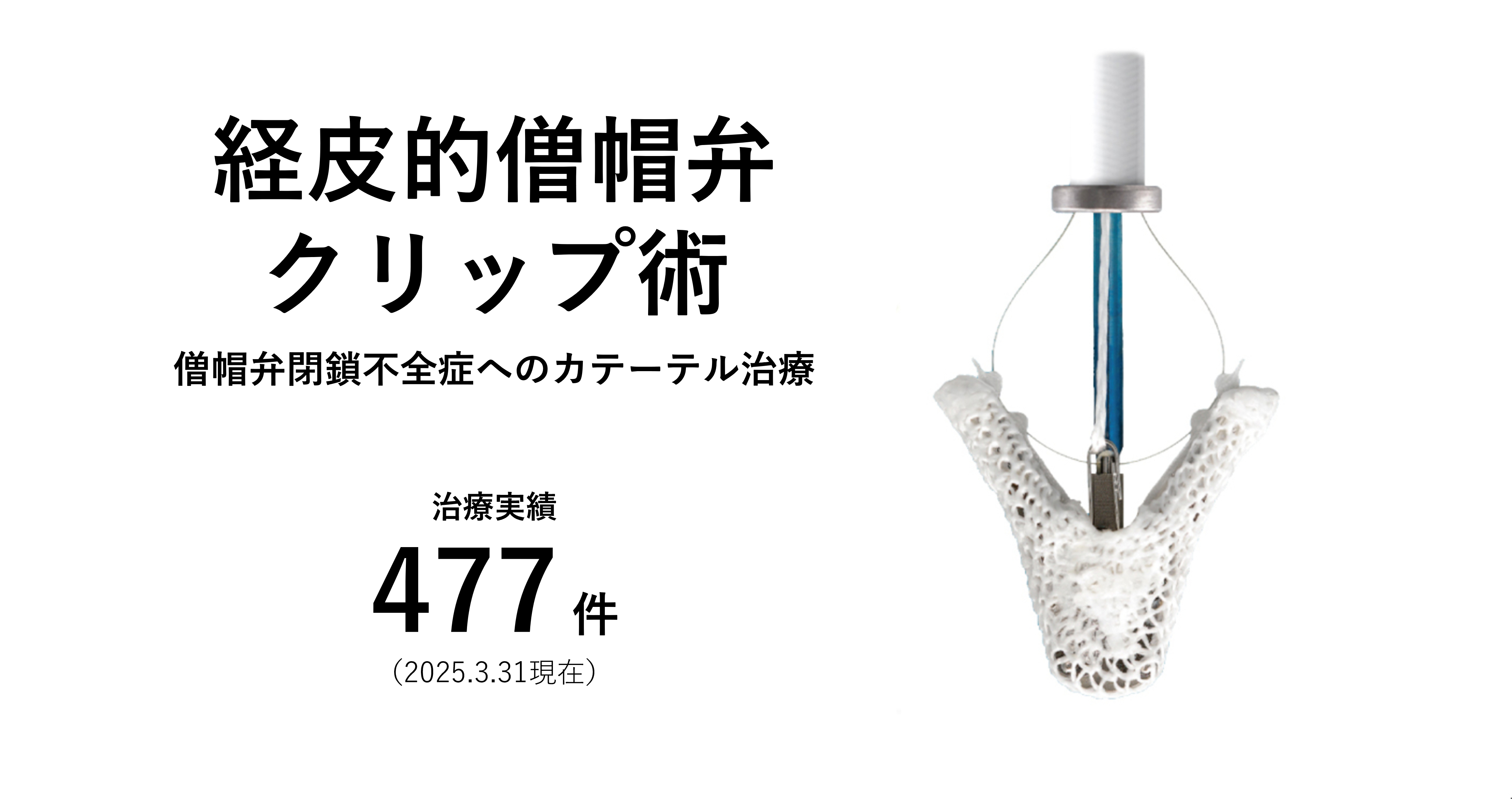 経皮的僧帽弁クリップ