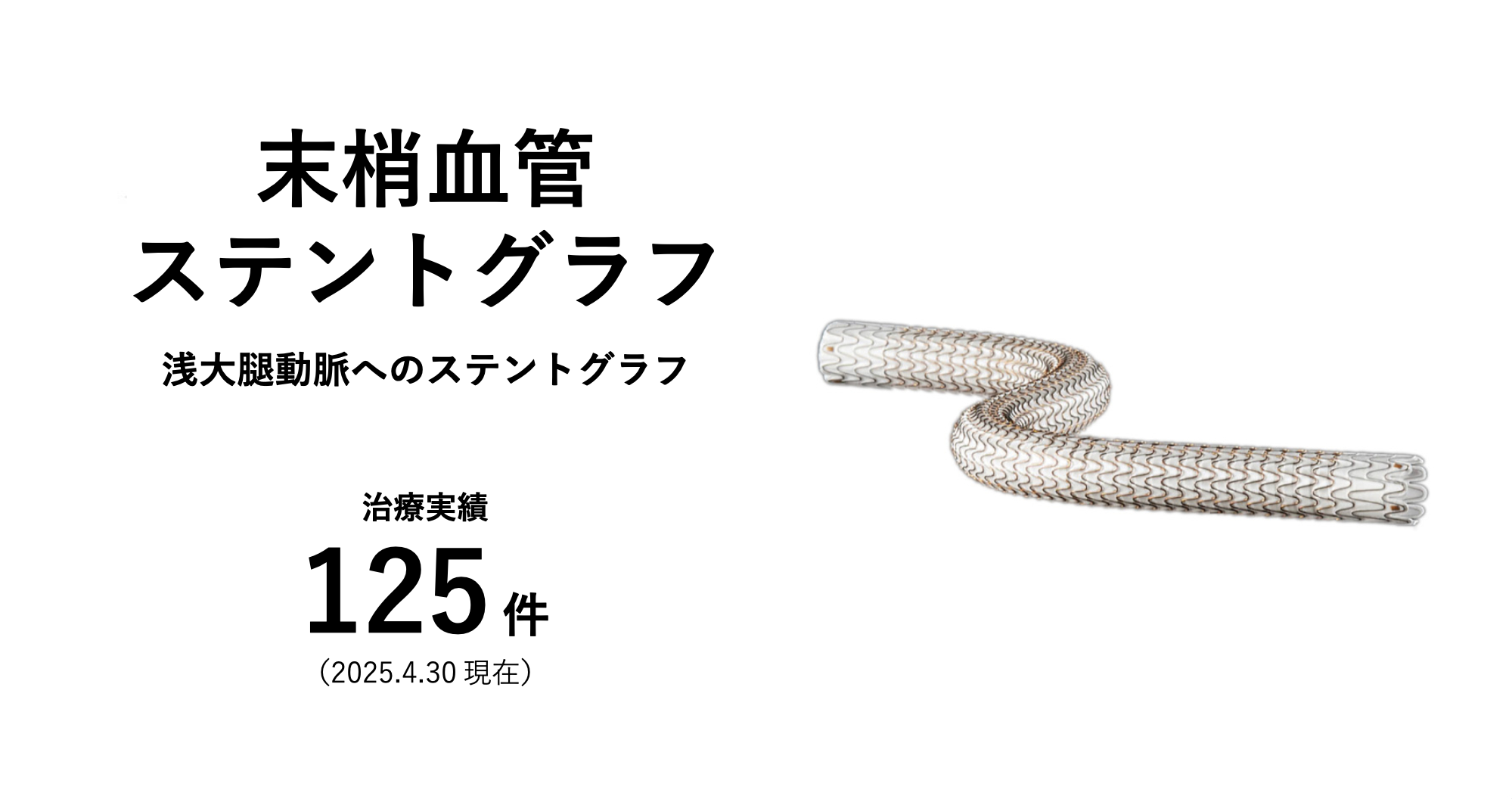 末梢血管ステントグラフ