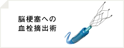 脳梗塞への血栓摘出術実用医