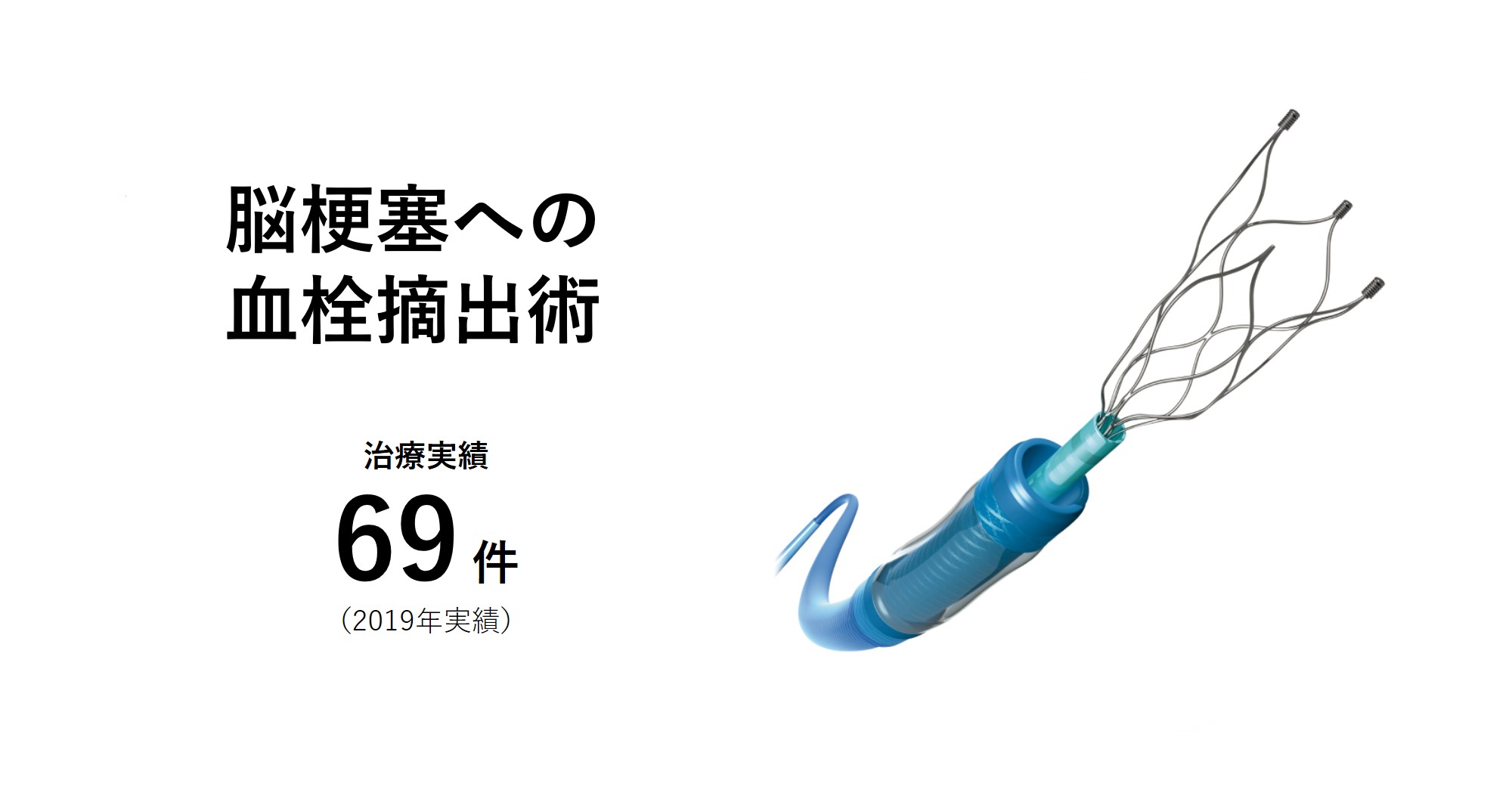脳梗塞への血栓摘出術