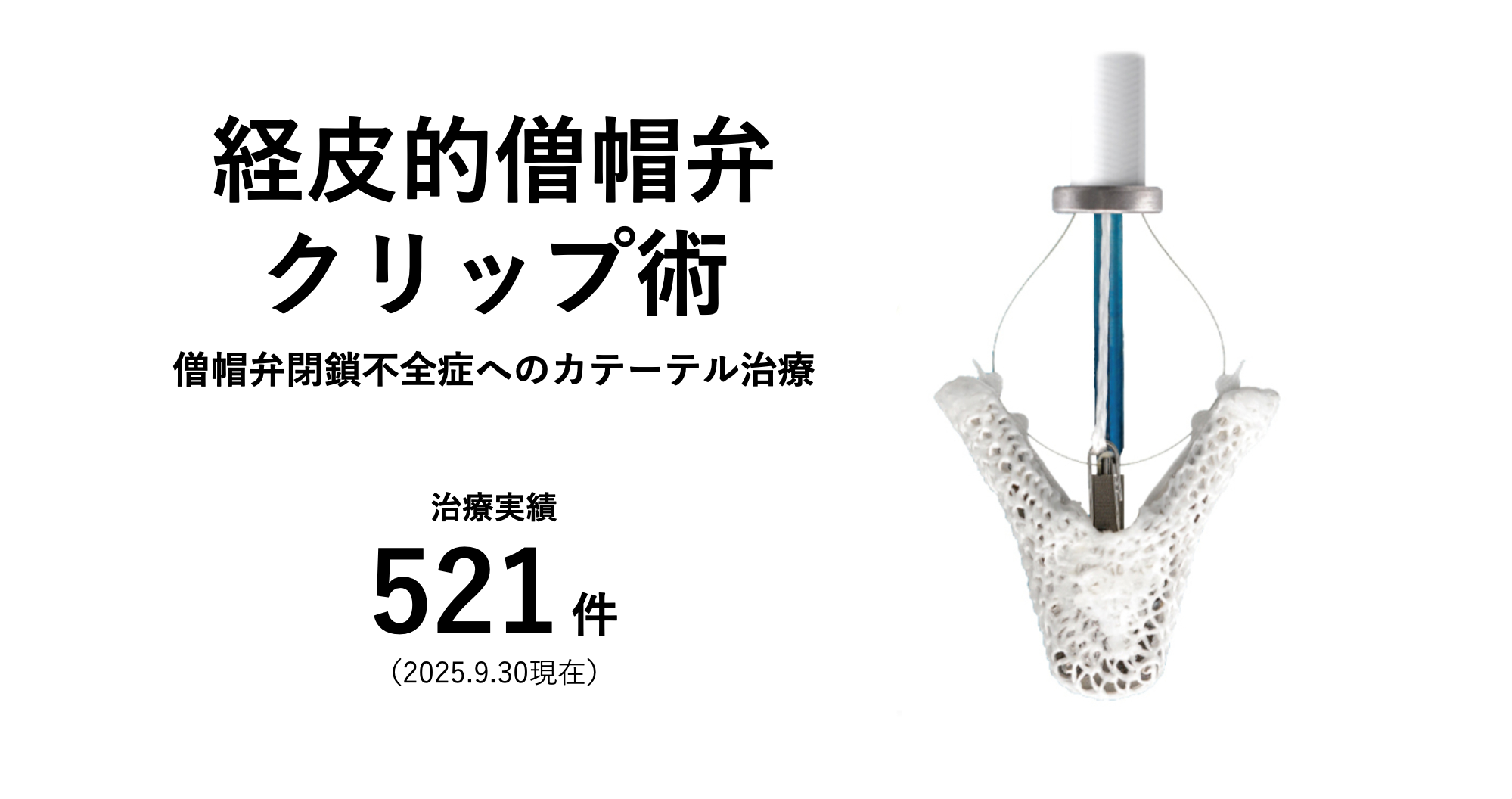 経皮的僧帽弁クリップ