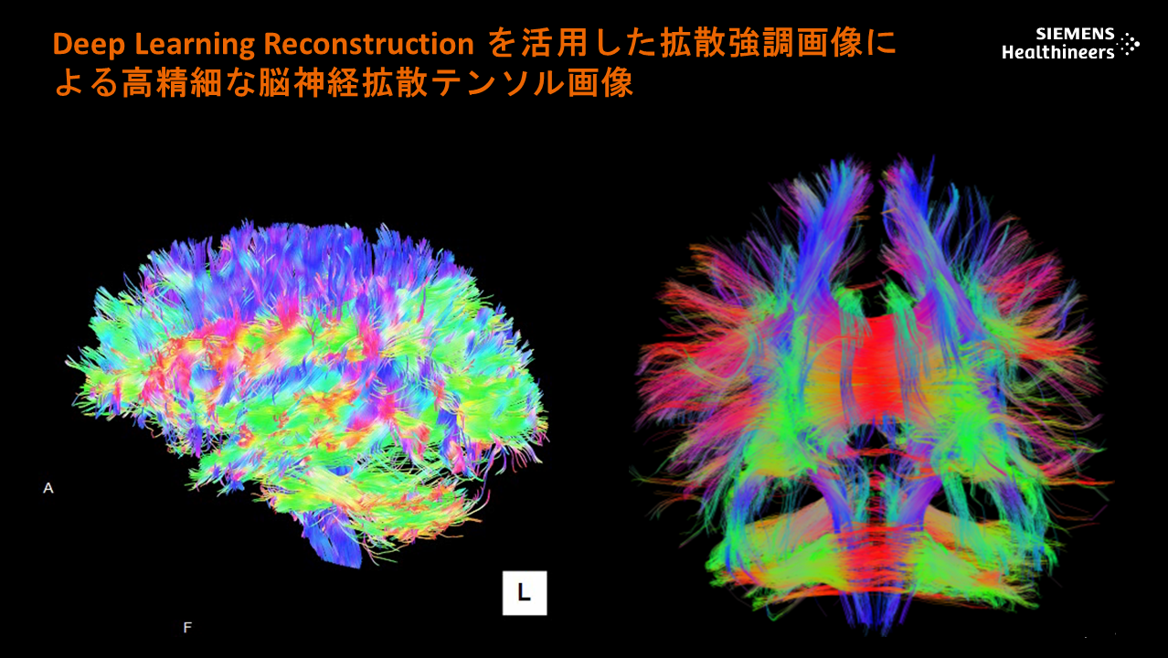 MAGNETOM Vida 高精細画像