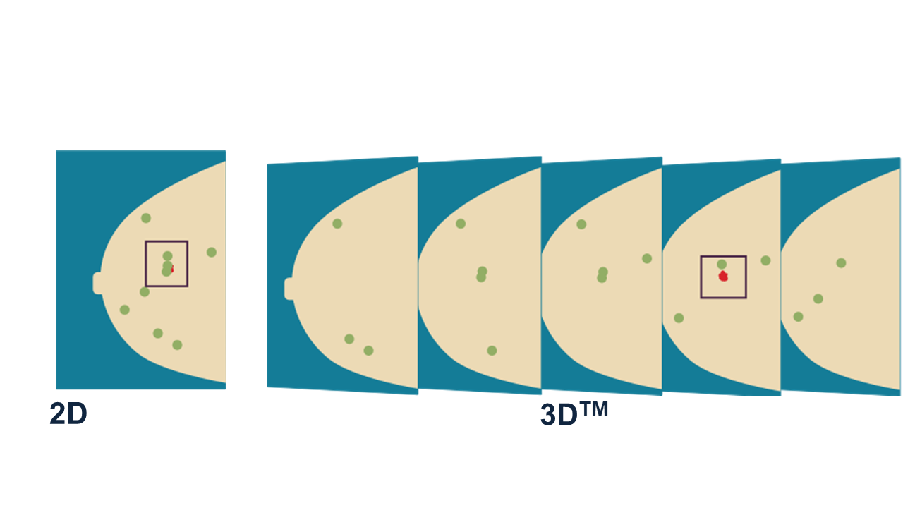 3Dimensions 3D画像